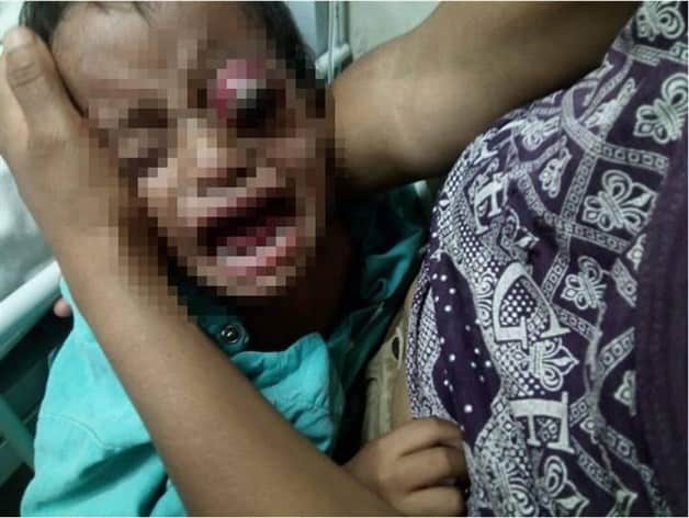 Niegan atención a niño a punto de perder ojo Niegan atención a niño a punto de perder ojo