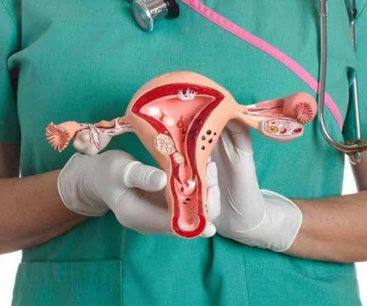 Refuerzan lucha contra cáncer cervicouterino en Tamaulipas