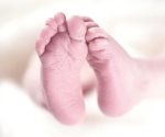 ¿Qué es el Síndrome de Rubinstein-Taybi?; conoce los síntomas