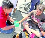 Ciclista se impacta contra vehículo; acaba chimuelo