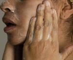 Dermatólogos advierten contra las rutinas de skin care demasiado complicadas