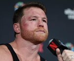 Saúl Canelo Álvarez se someterá a cirugía en el codo
