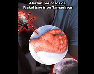Detectan casos probables de Rickettsiosis en personas de Reynosa y Nuevo Laredo