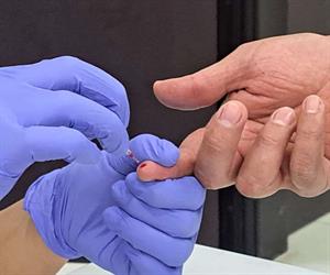 Detectan VIH en el CEDES