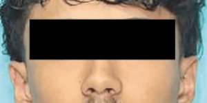 Arrestan a automovilista tras accidente en Mission