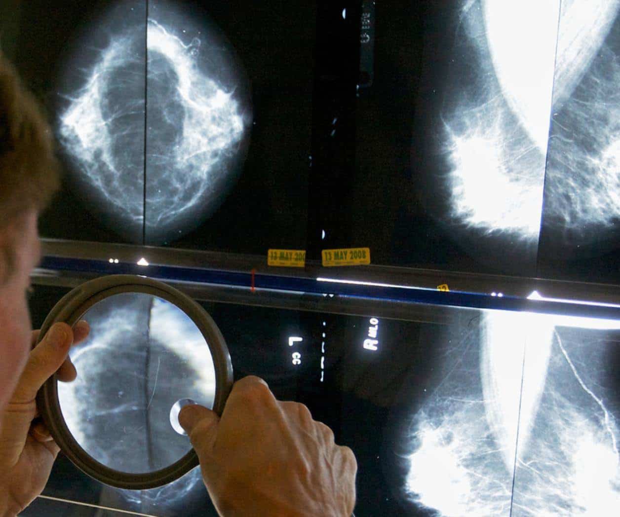 Investigación muestra impacto del COVID-19 en pacientes oncológicos
