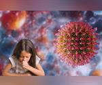 ¿Qué es el norovirus y cuáles son sus principales síntomas?