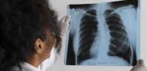 Investigan posible muerte de menor  por tuberculosis