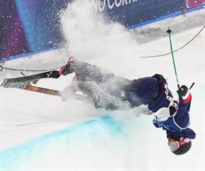 Goepper se va con esguince de rodilla y lesión en espinilla Goepper se va con esguince de rodilla y lesión en espinilla