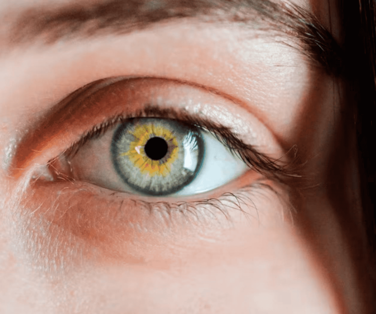 Día Mundial del Glaucoma: ¿qué es esta enfermedad?
