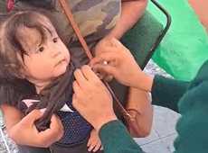 Módulos del IMSS 33 muestran poca asistencia tras pico por sarampión; vacuna de 6 meses a 49 años