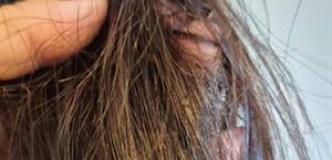 Donan en Nuevo Progreso cabello y atender derrame en el Golfo