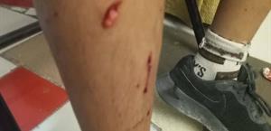 Alertan ataques caninos en la Paraíso norte