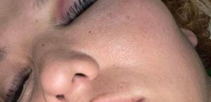 Mujer acusa a su pareja por presunta agresión