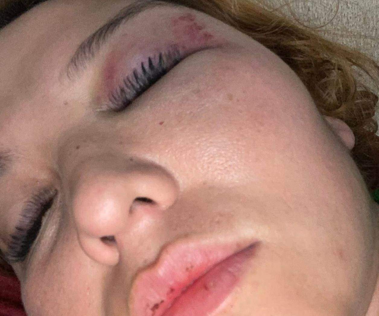 Mujer acusa a su pareja por presunta agresión
