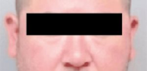 Ebrio golpea en la cabeza a joven; no quiso comprar cerveza a él y a sus amigos