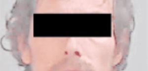 Lo acusan de intento de asesinato capital tras herir a un agente