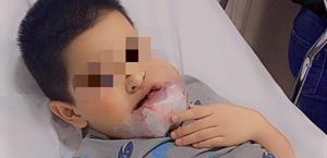 Pequeño de Río Bravo lucha contra tumor