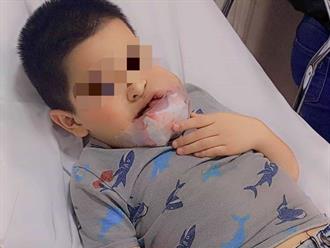 Pequeño de Río Bravo lucha contra tumor