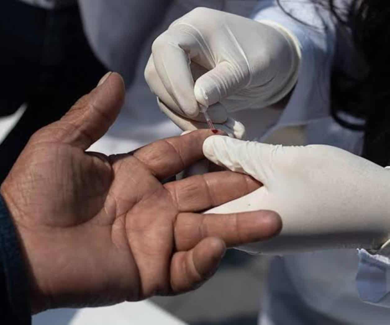 Suma Tamaulipas 42 casos de VIH