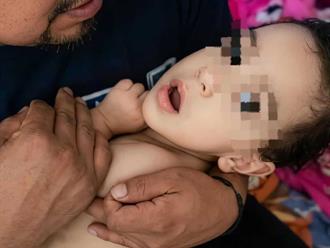 Padres piden apoyo para tratamiento de menor