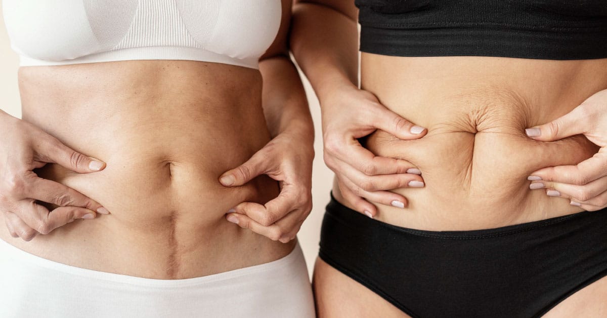 “El cuerpo después de la maternidad: entre la salud y la exigencia estética”