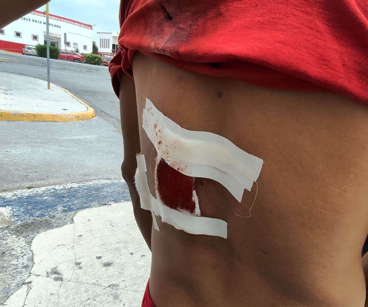 Lavacoches es apuñalado por compañera de labores