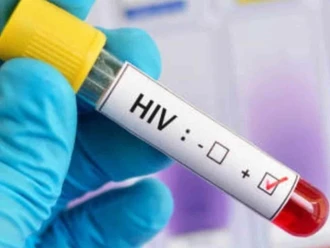 Detectan un caso de VIH cada tres días