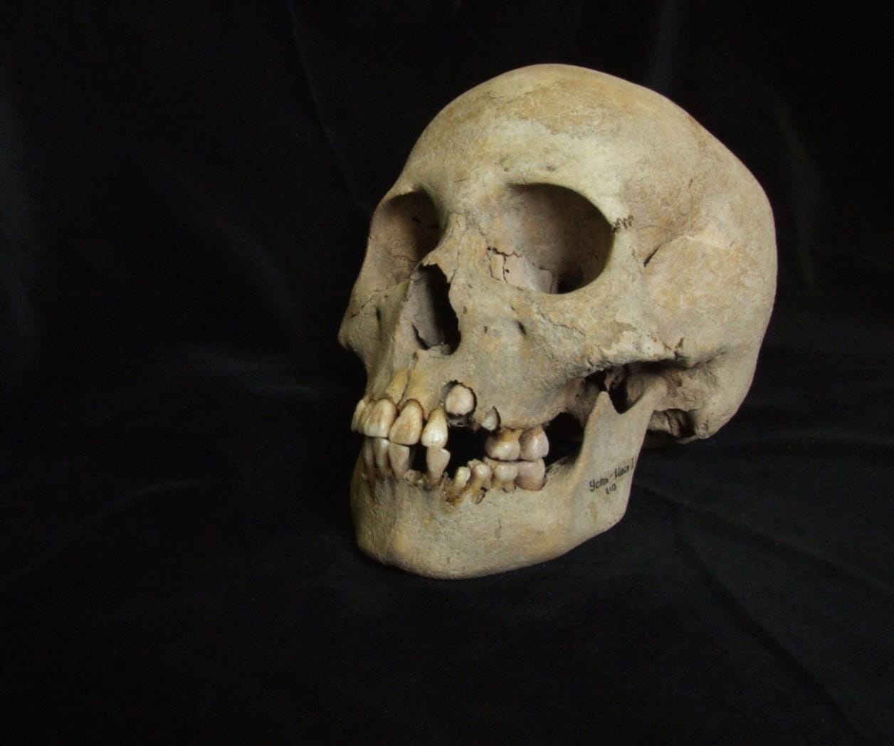 Científicos encuentran la evidencia más antigua de la peste, de hace 5.500 años.