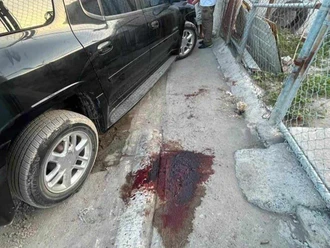 Choque deja un joven amputado en Río Bravo; conductora huye