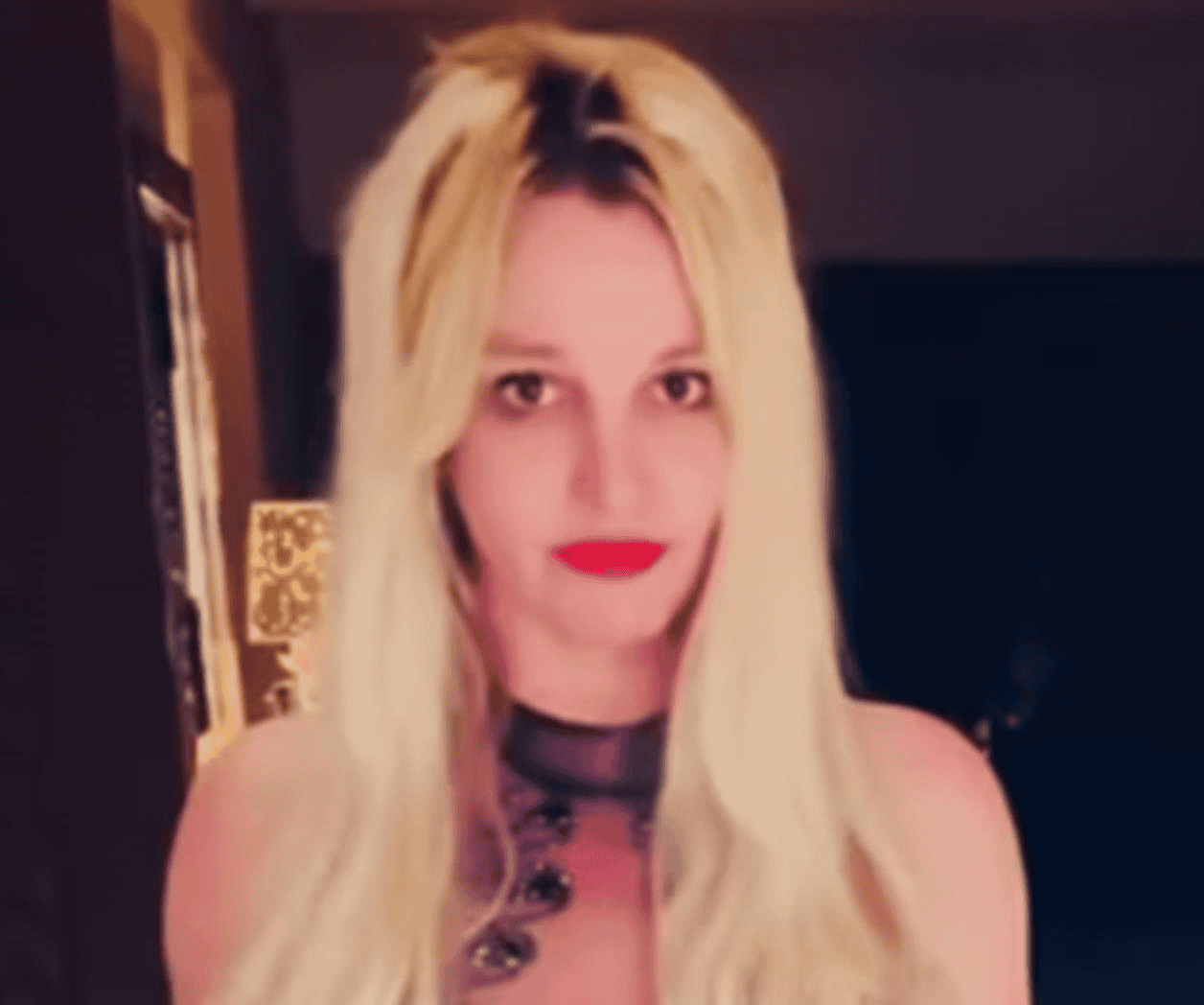 Sufre Britney al usar bótox en su cara