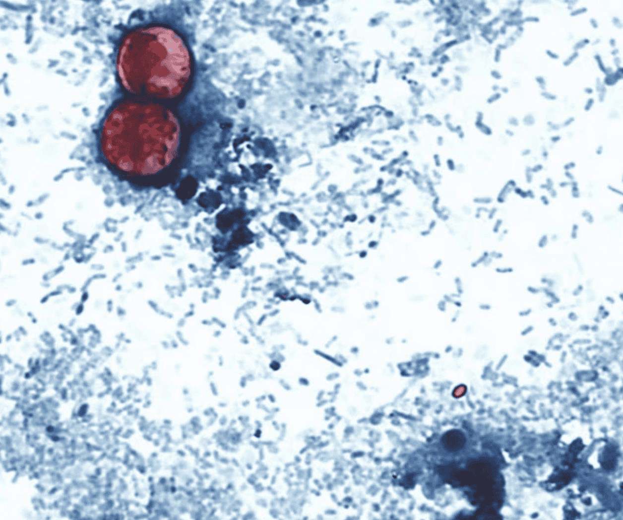 Funcionarios de EEUU vinculan brote de ciclosporiasis por lechuga a 3 estados más