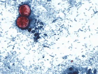 Cofepris descarta ciclosporiasis en hoteles de la Riviera Maya