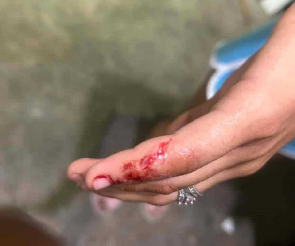 Deja altercado  en tienda  menor lesionada
