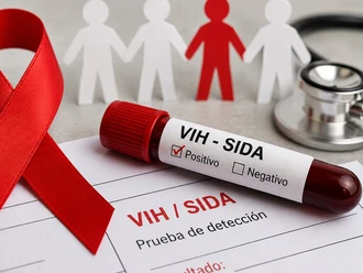 Suman 28 fallecimientos por VIH/SIDA