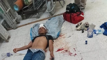 Preparan demanda por obrero lesionado