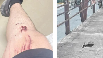 Sufre lesión al pasar por puente peatonal
