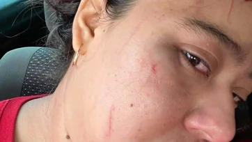 Golpean a mujer